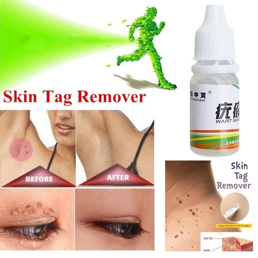 Skin marking mole and wart remover