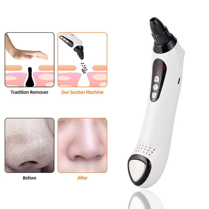 Blackhead Remover Vacuum Suction Skin Care