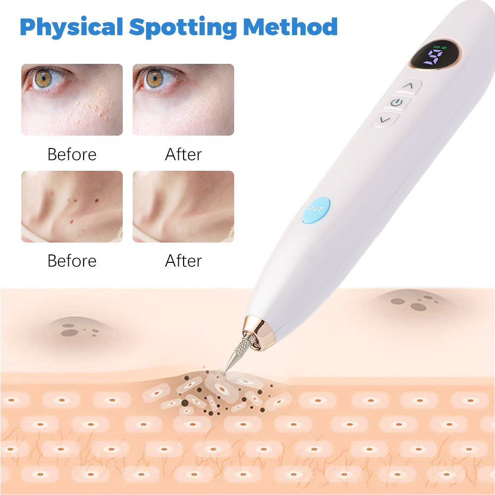 Laser Skin Tag Remover Face Mole